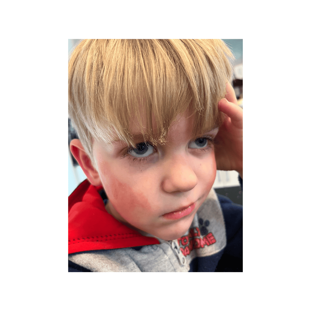 blonde boy with singed hair